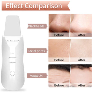 Ultrasonic Face Scrubber